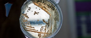 bacteria in a petri dish