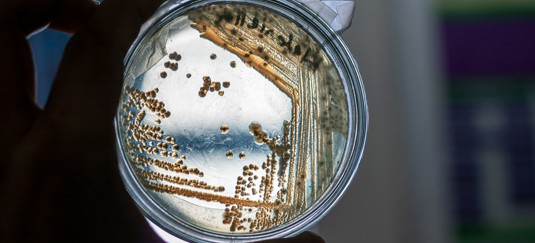 bacteria in a petri dish