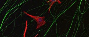 Microscopic view of nerve cells with red cell bodies and green axons against a dark background.