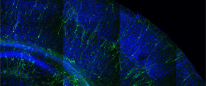 Microscopy image of nerve cells in a brain section, featuring a blue background and green highlights of nerve connections.