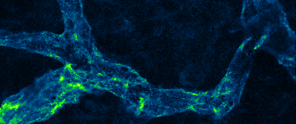Detailopname van heldergele cellulaire structuren op een donkerblauwe achtergrond, waarschijnlijk van een microscopische afbeelding.