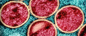 Six round virus particles in red with a golden outline, set against a turquoise background.